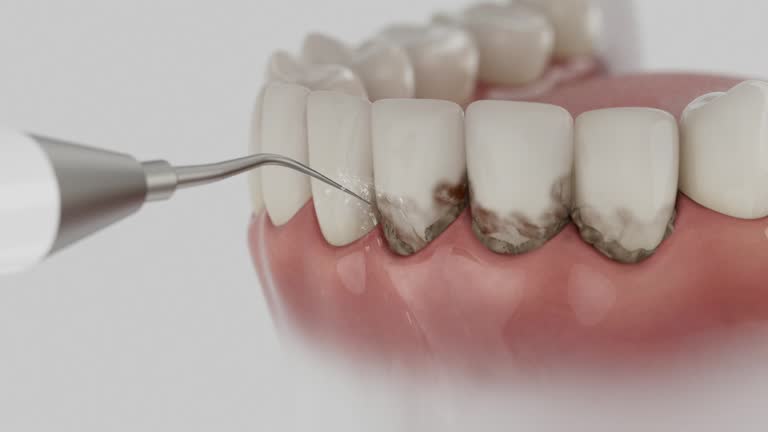 Trusted Teeth Cleaning And Checkup service in Central, LA - Dentist Open Now